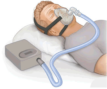 CPAP machine